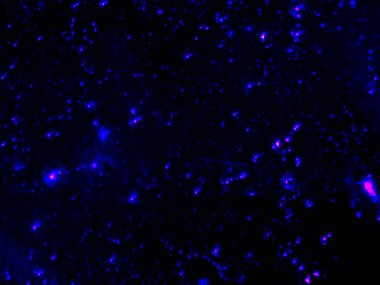 BHO 'nun fotoğrafı, ama kendinden yapılmış haşhaş yağı. Fotoğraf: mikroskop, serval efektli.