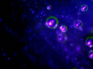 BHO 'nun fotoğrafı, ama kendinden yapılmış haşhaş yağı. Fotoğraf: mikroskop, serval efektli.