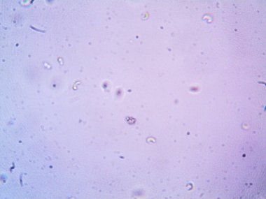 Mikroskop levenhuk fotoğrafı, amatör.