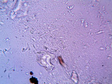 Mikroskop levenhuk fotoğrafı, amatör.