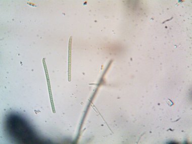 Mikroskop levenhuk fotoğrafı, amatör.