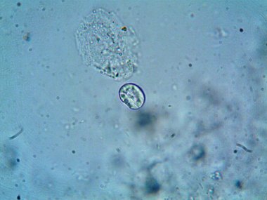 Mikroskop levenhuk fotoğrafı, amatör.