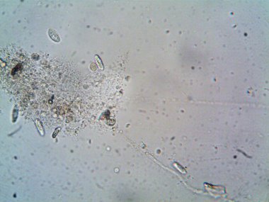 Mikroskop levenhuk fotoğrafı, amatör.