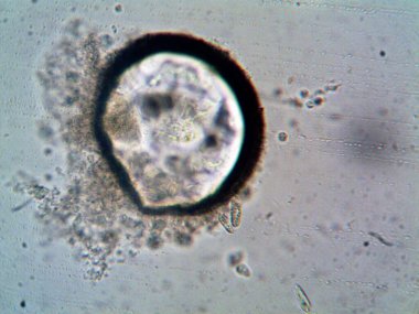 Mikroskop levenhuk fotoğrafı, amatör.