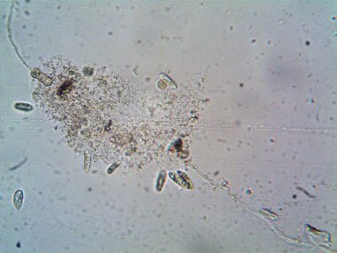 Mikroskop levenhuk fotoğrafı, amatör.