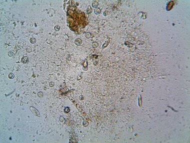 Mikroskop levenhuk fotoğrafı, amatör.