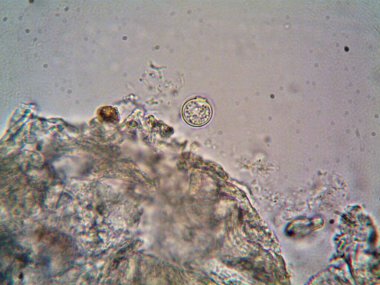 Mikroskop levenhuk fotoğrafı, amatör.