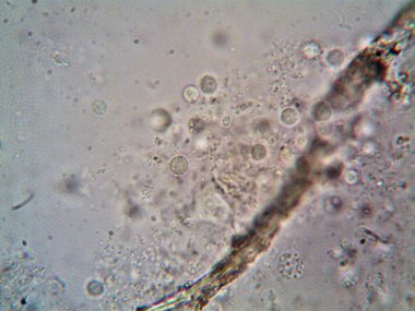 Mikroskop levenhuk fotoğrafı, amatör.