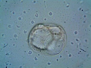 Mikroskop levenhuk fotoğrafı, amatör.