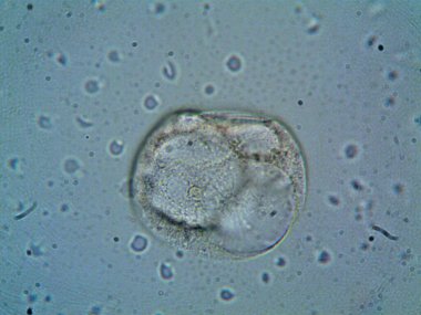 Mikroskop levenhuk fotoğrafı, amatör.