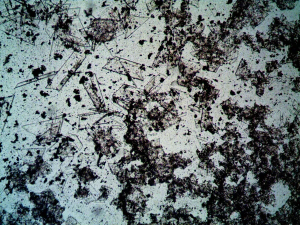 Мікроскоп Люк Фото Аматорське Стокове Зображення