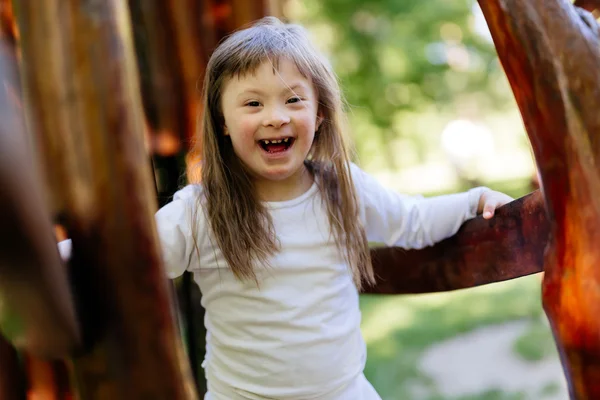 People with down syndrome — Stock Photo, Image