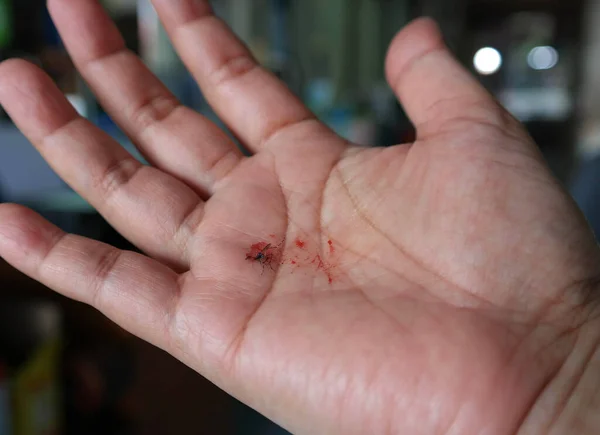 Mosquito Muerto Con Sangre Roja Palma Humana Casa —  Fotos de Stock