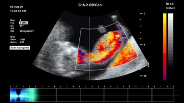insan embriyo Medikal ultrason taraması