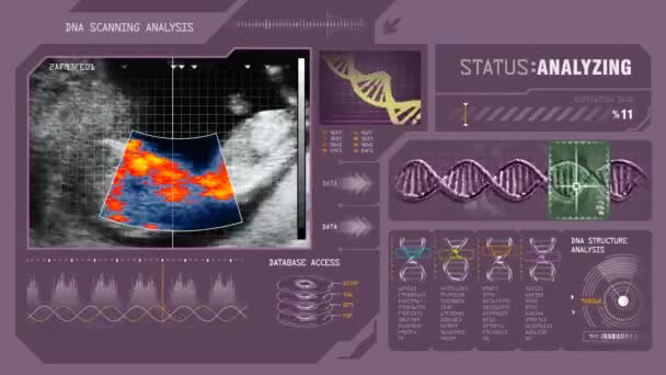 Scan des menschlichen Fötus in der Gebärmutter — Stockvideo