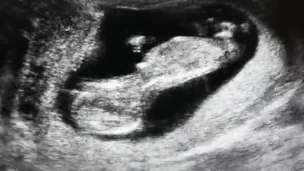 Insan embriyo ultrason inceden inceye gözden geçirmek — Stok video