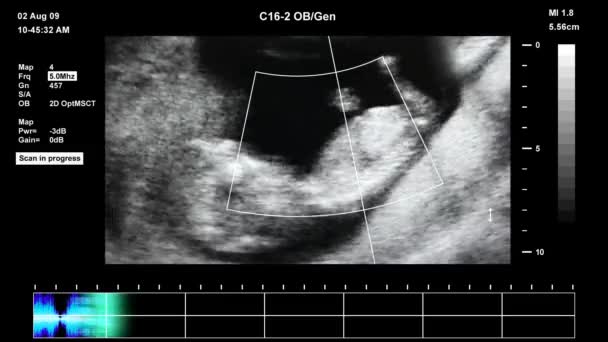 Medizinische Ultraschalluntersuchung des menschlichen Embryos — Stockvideo