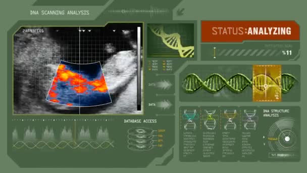 Scan van de menselijke foetus in de baarmoeder — Stockvideo