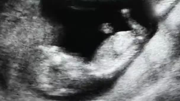Insan embriyo ultrason inceden inceye gözden geçirmek — Stok video
