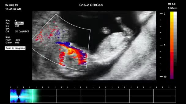 Medical ultrasound scan of human embryo — Stock Video