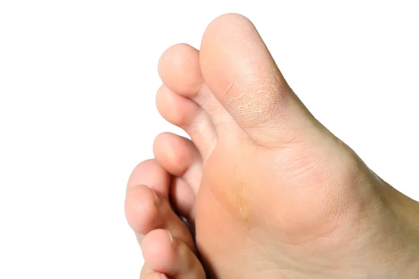 Women's voeten droog — Stockfoto