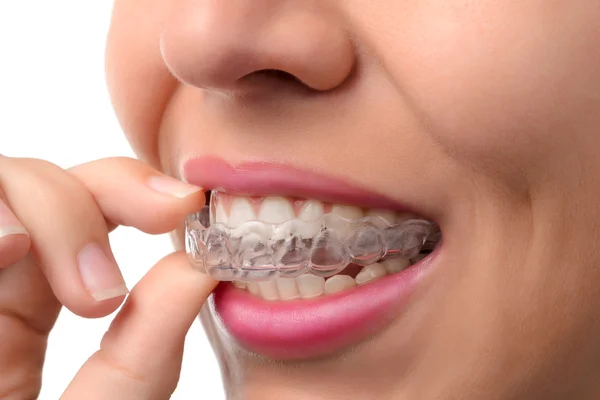 Woman wearing orthodontic silicone trainer — Stock Photo, Image