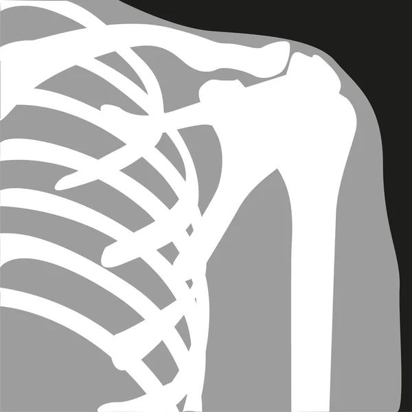 X-Ray. Symbool. Vectorillustratie. — Stockvector