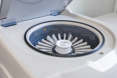 Açık santrifüj makinesi