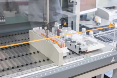 Plazma numuneleri steril kutusunda vardır