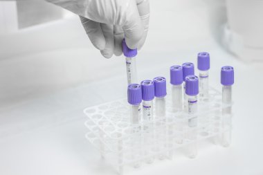 kan örnekleme için tüpler