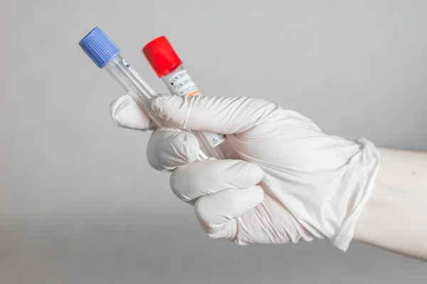 Tubos para amostragem de sangue — Fotografia de Stock