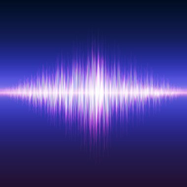 Parlak müzik ekolayzır