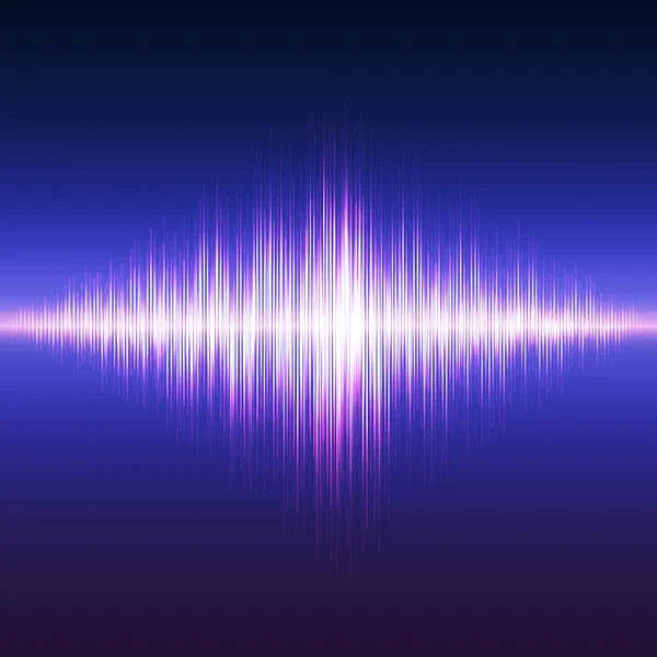 Parlak müzik ekolayzır