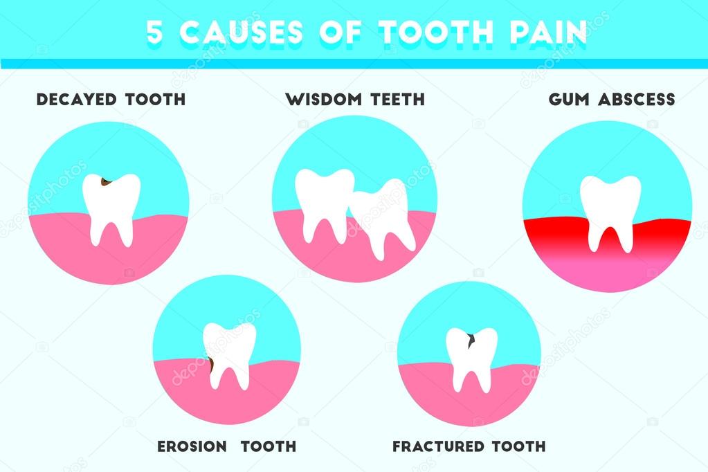 Common cause of tooth pain Stock Vector by 80104744