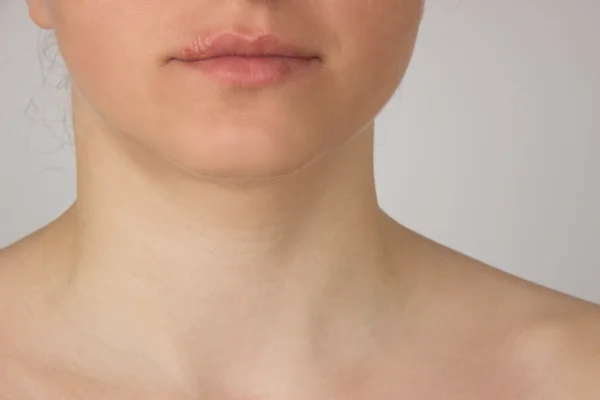 Herpes pijnlijke, met pus op de lippen van de mooie meisje en — Stockfoto