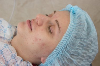 Profesyonel akne kabinde temizlik yüz