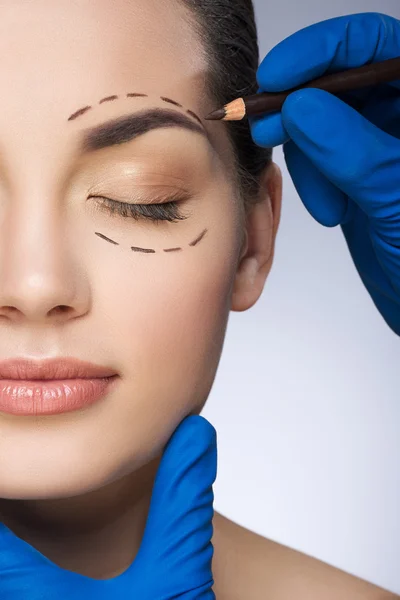 Le chirurgien dessine des lignes pointillées autour des yeux fermés de la fille — Photo