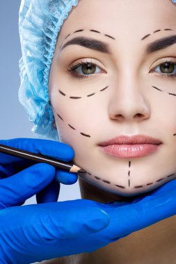 Hastanın yüz delikli çizgiler