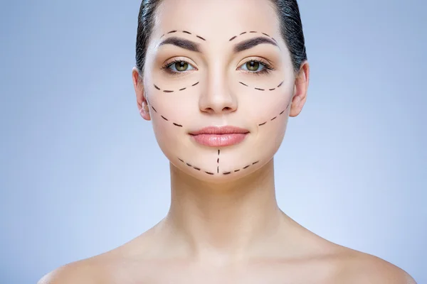 Lignes de perforation sur le visage du patient — Photo