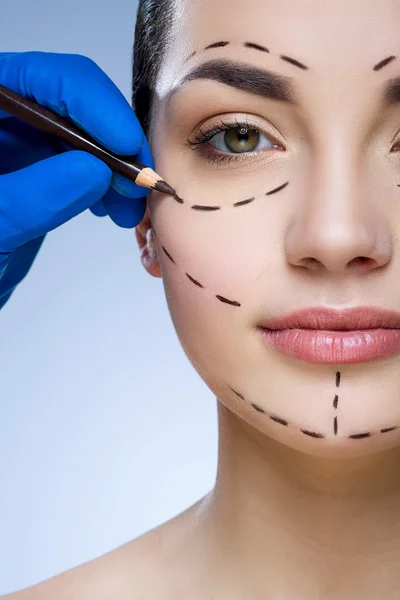 Lignes de perforation sur le visage du patient — Photo