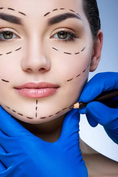 Linhas de perfuração no rosto do paciente — Fotografia de Stock