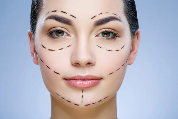 Lignes de perforation sur le visage du patient — Photo