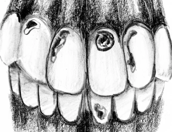 Teeth Decay Pencil Artwork White Paper — Stock Photo, Image