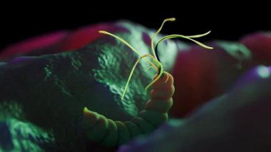 Helicobacter pillori, spiral şekilli, kırbaçlanmış bir bakteri mide zarını enfekte ediyor. Bu mikroorganizma peptik ülser, gastrit ve diğer gastrointestinal hastalıkların birincil nedenidir.