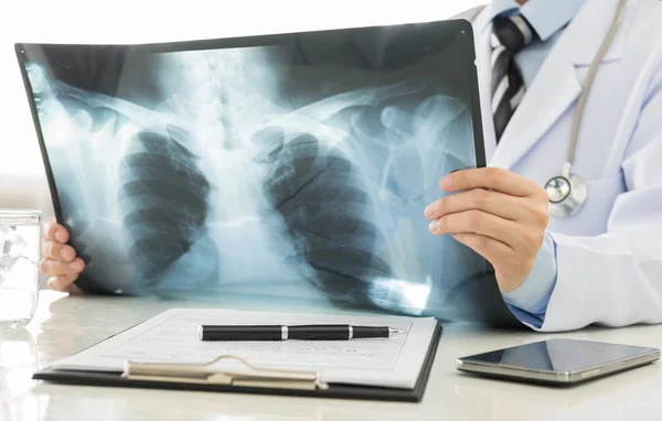 X-ray, doctor holding x-ray — Stock Photo, Image