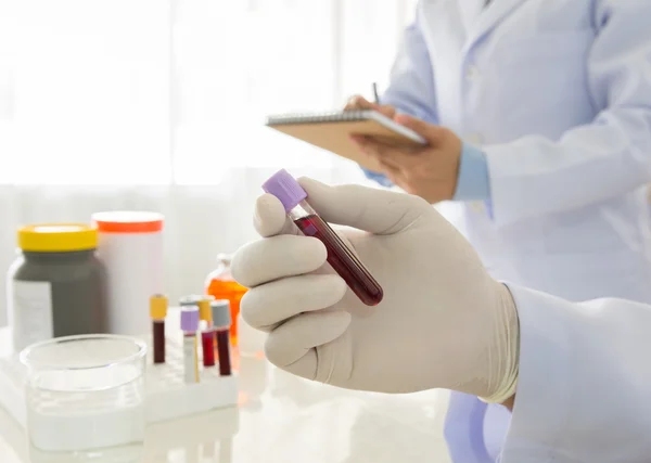 Blood tests, Doctor holding a bottle of blood — Stock Photo, Image