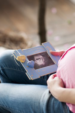 hamile kadınlar bebeklerini ultrason resimleri izliyor