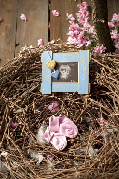 Ultrasound scan of  baby with small pink socks in nest — Stock Photo, Image