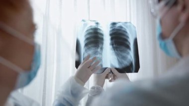 Ciğerlerinin röntgenini inceleyen kadın ve erkek doktorların yakın plan görüntüleri. Profesyonel erkek ve kadın içeride hastanede koronavirüs semptomlarını tartışıyor. Salgın konsepti.