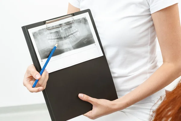 Dentista mostrando o raio-X para sua cliente — Fotografia de Stock